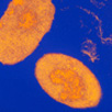 bacterium Bordetella pertussis